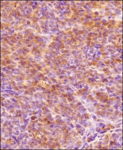 Invitrogen HIF1A Polyclonal Antibody 100 &mu;L | Buy Online | Invitrogen&trade; | Fisher Scientific