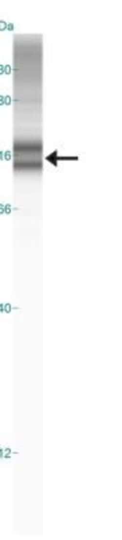 Invitrogen HIF1A Polyclonal Antibody 100 &mu;L | Buy Online | Invitrogen&trade; | Fisher Scientific