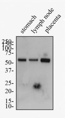 Invitrogen LYVE1 Polyclonal Antibody 100 &mu;L; Unconjugated:Antibodies,