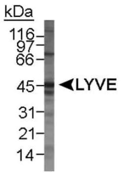 Invitrogen LYVE1 Polyclonal Antibody 100 &mu;L; Unconjugated:Antibodies,