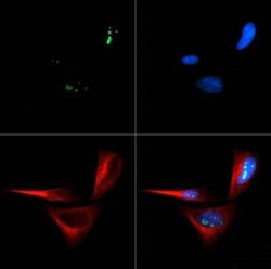 Invitrogen p14ARF Polyclonal Antibody 100 &mu;L; Unconjugated:Antibodies,