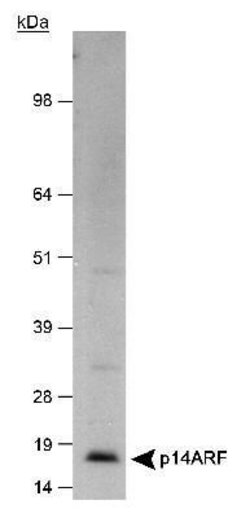 Invitrogen p14ARF Polyclonal Antibody 100 &mu;L; Unconjugated:Antibodies,