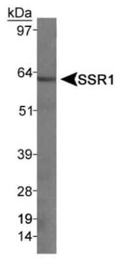 Invitrogen SSTR1 Polyclonal Antibody 100 &mu;L | Buy Online | Invitrogen&trade; | Fisher Scientific