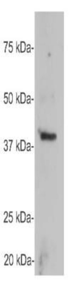 Invitrogen GAP43 Polyclonal Antibody 100 &mu;L; Unconjugated:Antibodies,