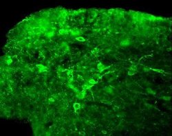Invitrogen NKB Polyclonal Antibody 100 &mu;L; Unconjugated:Antibodies,