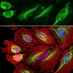 Invitrogen Vimentin Polyclonal Antibody 100 &mu;L; Unconjugated:Antibodies,