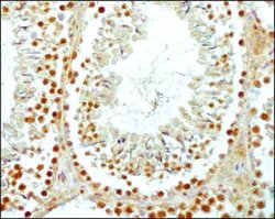 Invitrogen SCP3 Polyclonal Antibody 100 &mu;L; Unconjugated:Antibodies,