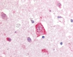 Invitrogen LRRK2 Polyclonal Antibody 100 &mu;L; Unconjugated:Antibodies,