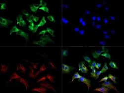 Invitrogen SLC7A11 Polyclonal Antibody 100 &mu;L | Buy Online | Invitrogen&trade; | Fisher Scientific