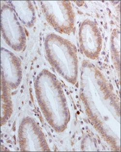 Invitrogen SLC7A11 Polyclonal Antibody 100 &mu;L | Buy Online | Invitrogen&trade; | Fisher Scientific