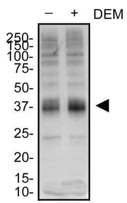 Invitrogen SLC7A11 Polyclonal Antibody 100 &mu;L | Buy Online | Invitrogen&trade; | Fisher Scientific