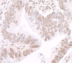 Invitrogen GAPDH Polyclonal Antibody 100 &mu;L | Buy Online | Invitrogen&trade; | Fisher Scientific