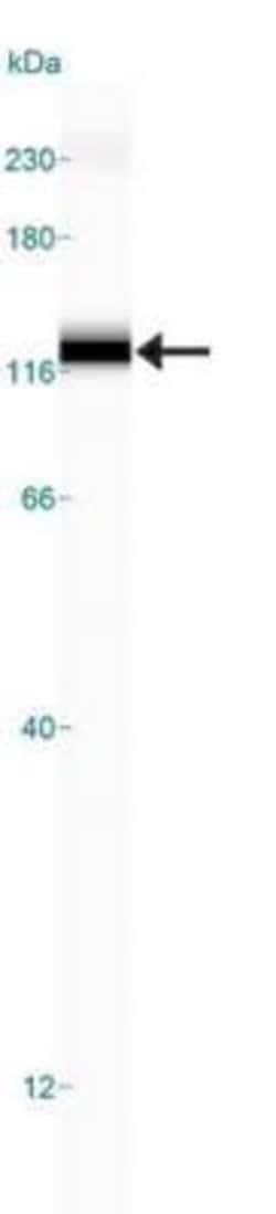 Invitrogen SR-BI Polyclonal Antibody 100 &mu;L; Unconjugated:Antibodies,