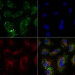 Invitrogen ABCA1 Polyclonal Antibody 100 &mu;L | Buy Online | Invitrogen&trade; | Fisher Scientific