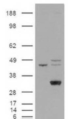 Invitrogen LIPG Polyclonal Antibody 100 &mu;L | Buy Online | Invitrogen&trade; | Fisher Scientific