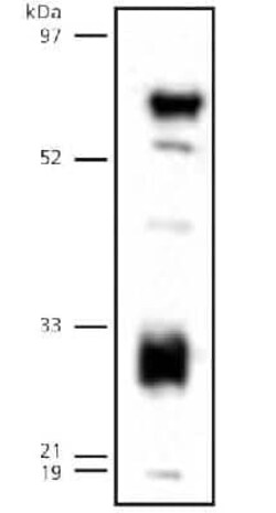 Invitrogen LIPG Polyclonal Antibody 100 &mu;L | Buy Online | Invitrogen&trade; | Fisher Scientific