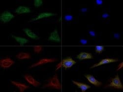 Invitrogen LIPG Polyclonal Antibody 100 &mu;L; Unconjugated:Antibodies,