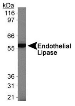 Invitrogen LIPG Polyclonal Antibody 100 &mu;L | Buy Online | Invitrogen&trade; | Fisher Scientific
