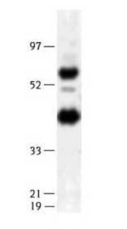 Invitrogen LIPG Polyclonal Antibody 100 &mu;L | Buy Online | Invitrogen&trade; | Fisher Scientific