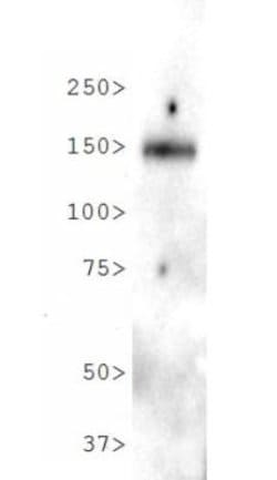 Invitrogen NPC1L1 Polyclonal Antibody 100 &mu;L; Unconjugated:Antibodies,
