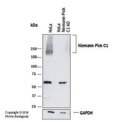 Invitrogen NPC1 Polyclonal Antibody 100 &mu;L; Unconjugated:Antibodies,