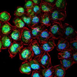 Invitrogen CENPF Polyclonal Antibody 100 &mu;L; Unconjugated:Antibodies,