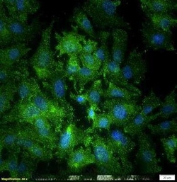 Invitrogen NUMB Polyclonal Antibody 100 &mu;L; Unconjugated:Antibodies,