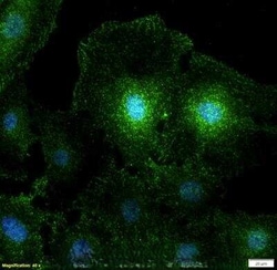 Invitrogen NUMB Polyclonal Antibody 100 &mu;L; Unconjugated:Antibodies,