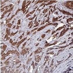 Invitrogen Survivin Polyclonal Antibody 100 &mu;L; Unconjugated:Antibodies,