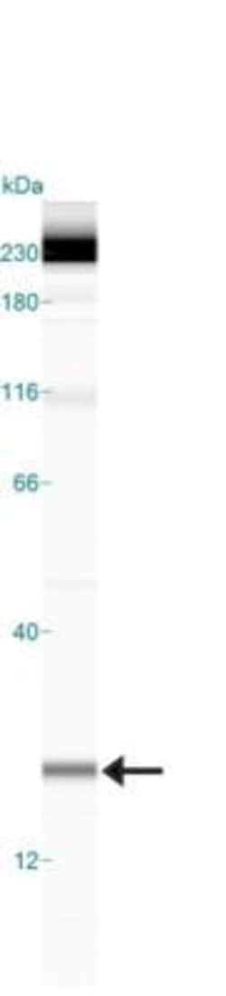 Invitrogen Survivin Polyclonal Antibody 100 &mu;L; Unconjugated:Antibodies,