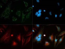 Invitrogen Beclin 1 Polyclonal Antibody 100 &mu;L; Unconjugated:Antibodies,