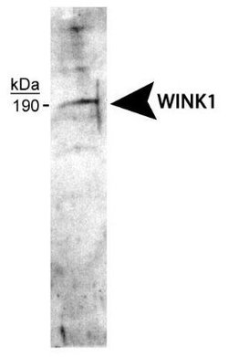 WNK1 Polyclonal Antibody, Invitrogen 100 &mu;L | Buy Online | Invitrogen | Fisher Scientific