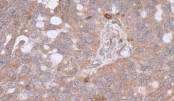 Invitrogen beta Actin Polyclonal Antibody 100 &mu;g; Unconjugated:Antibodies,