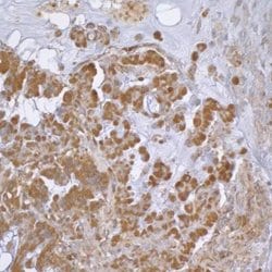 Invitrogen beta Actin Polyclonal Antibody 100 &mu;g; Unconjugated:Antibodies,