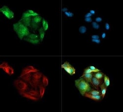 Invitrogen PSMD10 Polyclonal Antibody 100 &mu;L | Buy Online | Invitrogen&trade; | Fisher Scientific