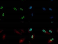 Invitrogen JARID2 Polyclonal Antibody 100 &mu;L | Buy Online | Invitrogen&trade; | Fisher Scientific