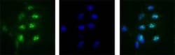 Invitrogen Nucleolin Polyclonal Antibody 100 &mu;L | Buy Online | Invitrogen&trade; | Fisher Scientific