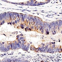 Invitrogen Nucleolin Polyclonal Antibody 100 &mu;L | Buy Online | Invitrogen&trade; | Fisher Scientific