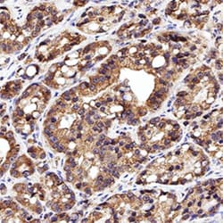 Invitrogen Calreticulin Polyclonal Antibody 100 &mu;L; Unconjugated:Antibodies,