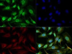 Invitrogen HMGB1 Polyclonal Antibody 100 &mu;L | Buy Online | Invitrogen&trade; | Fisher Scientific