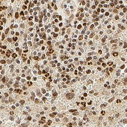 Invitrogen Phospho-IRE1 alpha (Ser724) Polyclonal Antibody 100 &mu;L; Unconjugated:Antibodies,