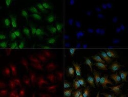 Invitrogen IRE1 alpha Polyclonal Antibody 100 &mu;L | Buy Online | Invitrogen&trade; | Fisher Scientific