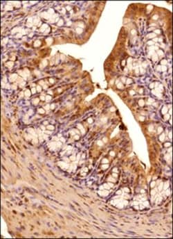 Invitrogen IRE1 alpha Polyclonal Antibody 100 &mu;L; Unconjugated:Antibodies,