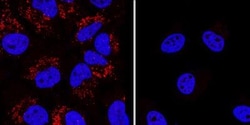Invitrogen LC3B Polyclonal Antibody 100 &mu;L; Unconjugated:Antibodies,