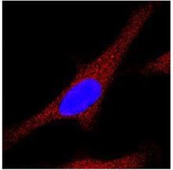 Invitrogen LC3A/LC3B Polyclonal Antibody 100 &mu;L; Unconjugated:Antibodies,