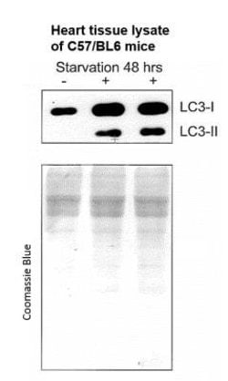 Invitrogen LC3A/LC3B Polyclonal Antibody 100 &mu;L; Unconjugated:Antibodies,