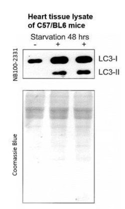 Invitrogen LC3A/LC3B Polyclonal Antibody 100 &mu;L; Unconjugated:Antibodies,
