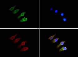 Invitrogen SEMA3B Polyclonal Antibody 50 &mu;L | Buy Online | Invitrogen&trade; | Fisher Scientific