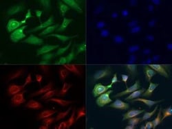 Invitrogen SEMA3B Polyclonal Antibody 50 &mu;L | Buy Online | Invitrogen&trade; | Fisher Scientific