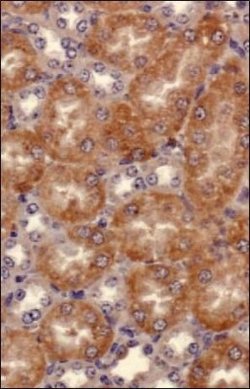 Invitrogen SEMA3B Polyclonal Antibody 50 &mu;L | Buy Online | Invitrogen&trade; | Fisher Scientific
